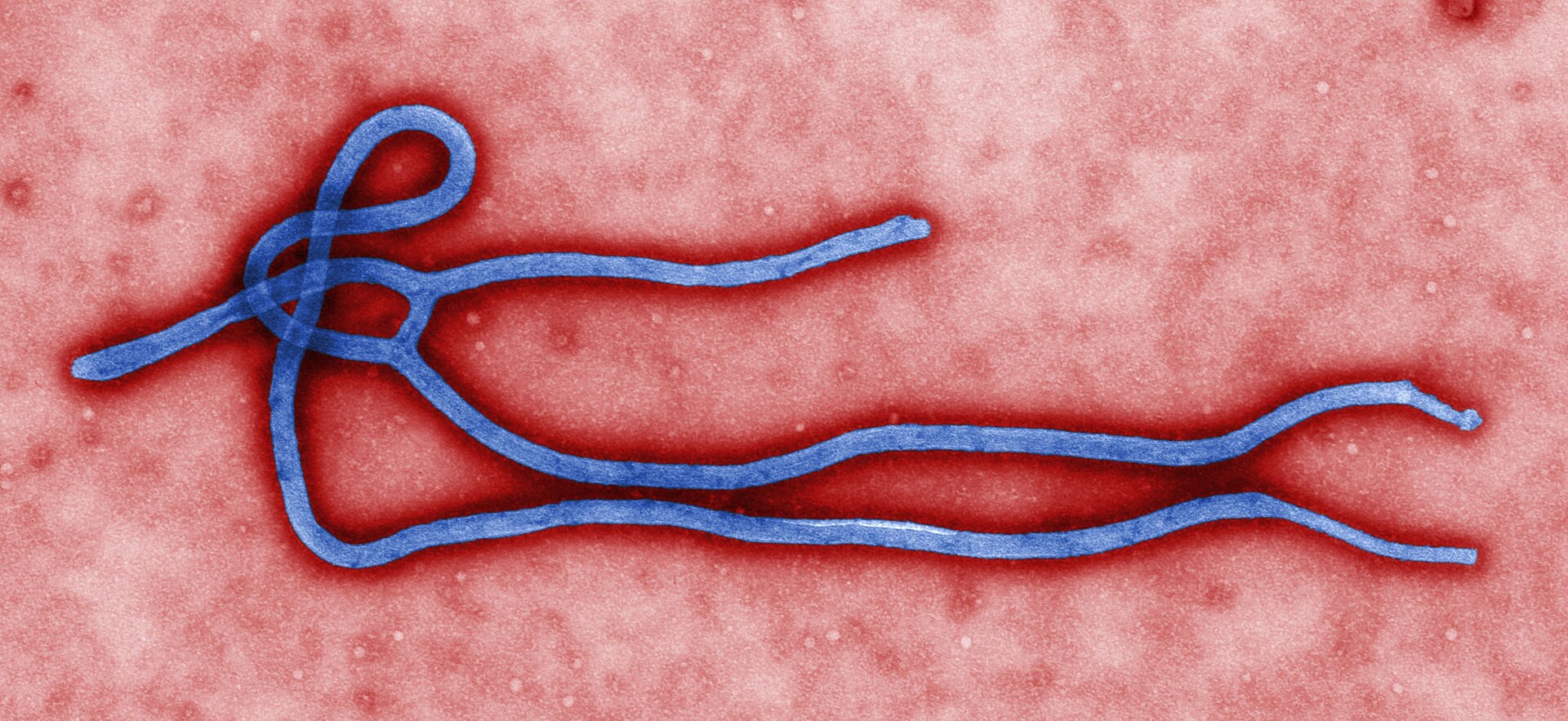 Colorized transmission electron micrograph of an Ebola virus virion