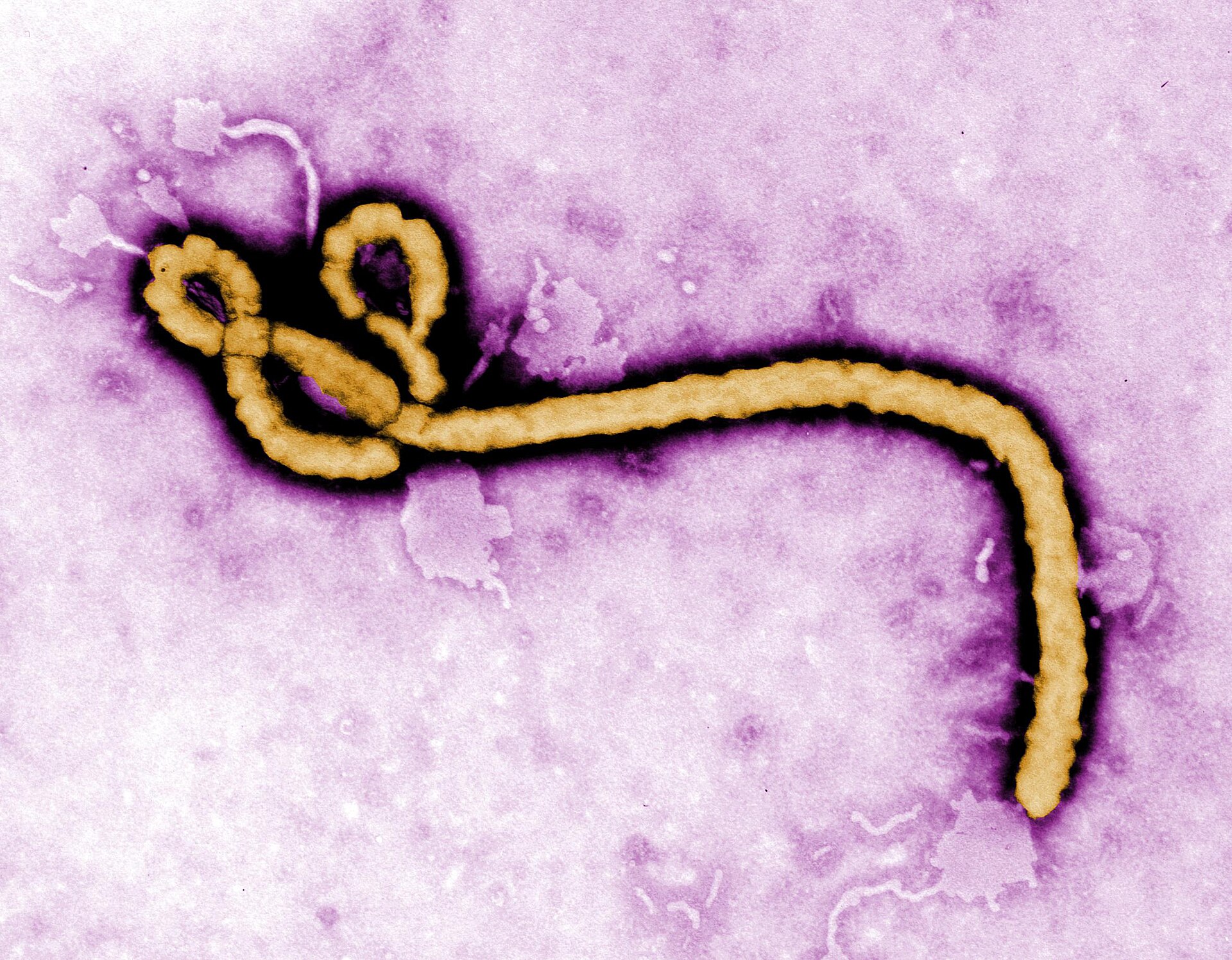 Colorized transmission electron micrograph of Ebola virus particles